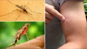 Zasadte ho do záhrady. Komáre a kliešte nenávidia jeho zápach.